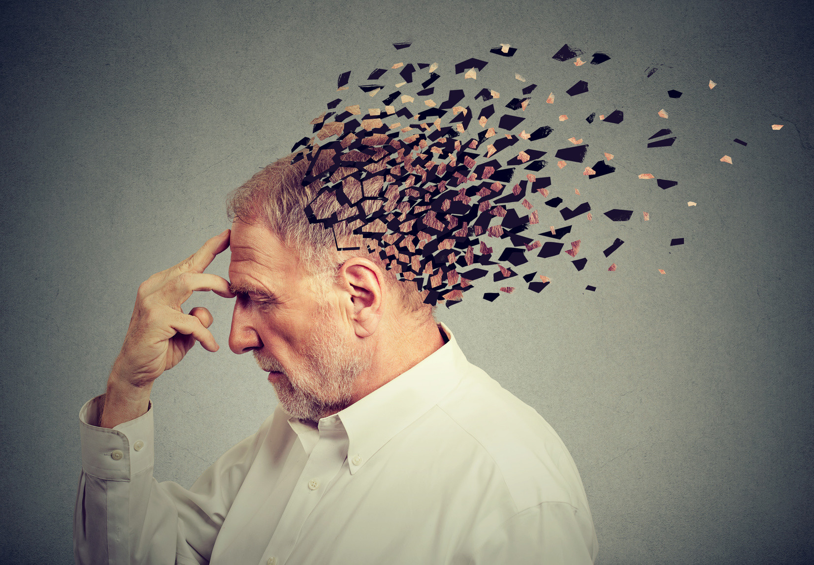 Fehlgeschlagene Haartransplantation