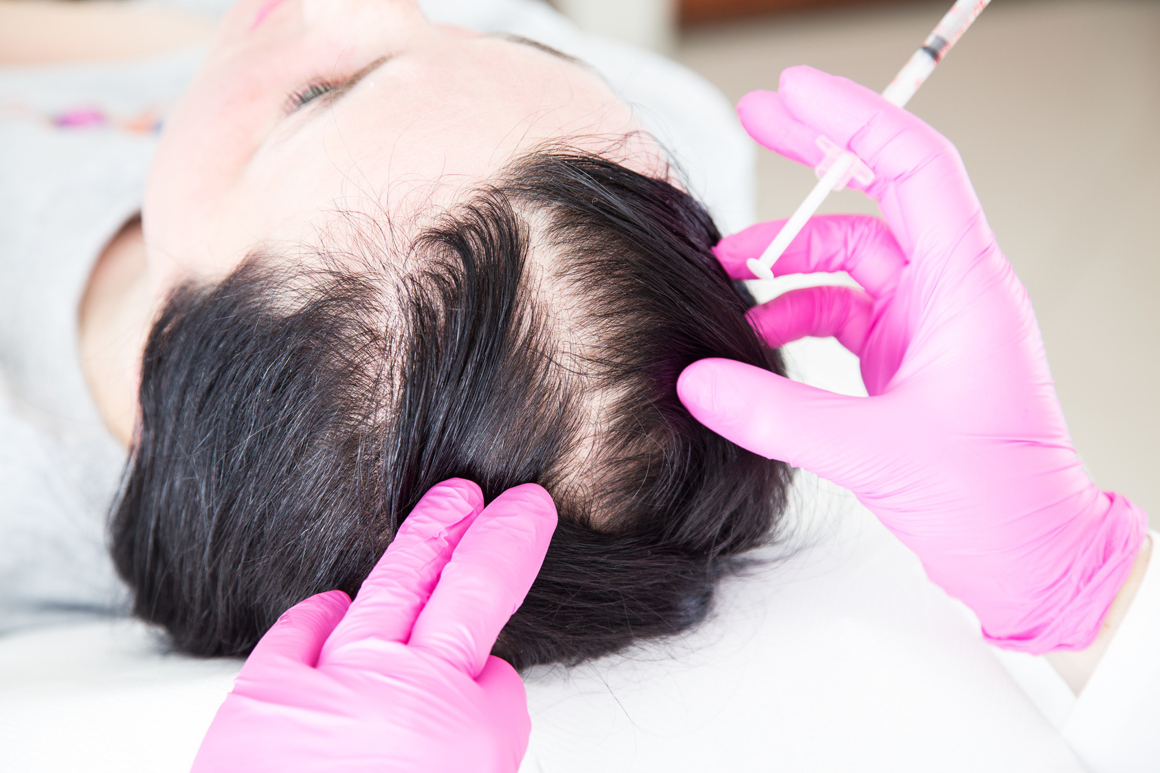 Haarpigmentierung