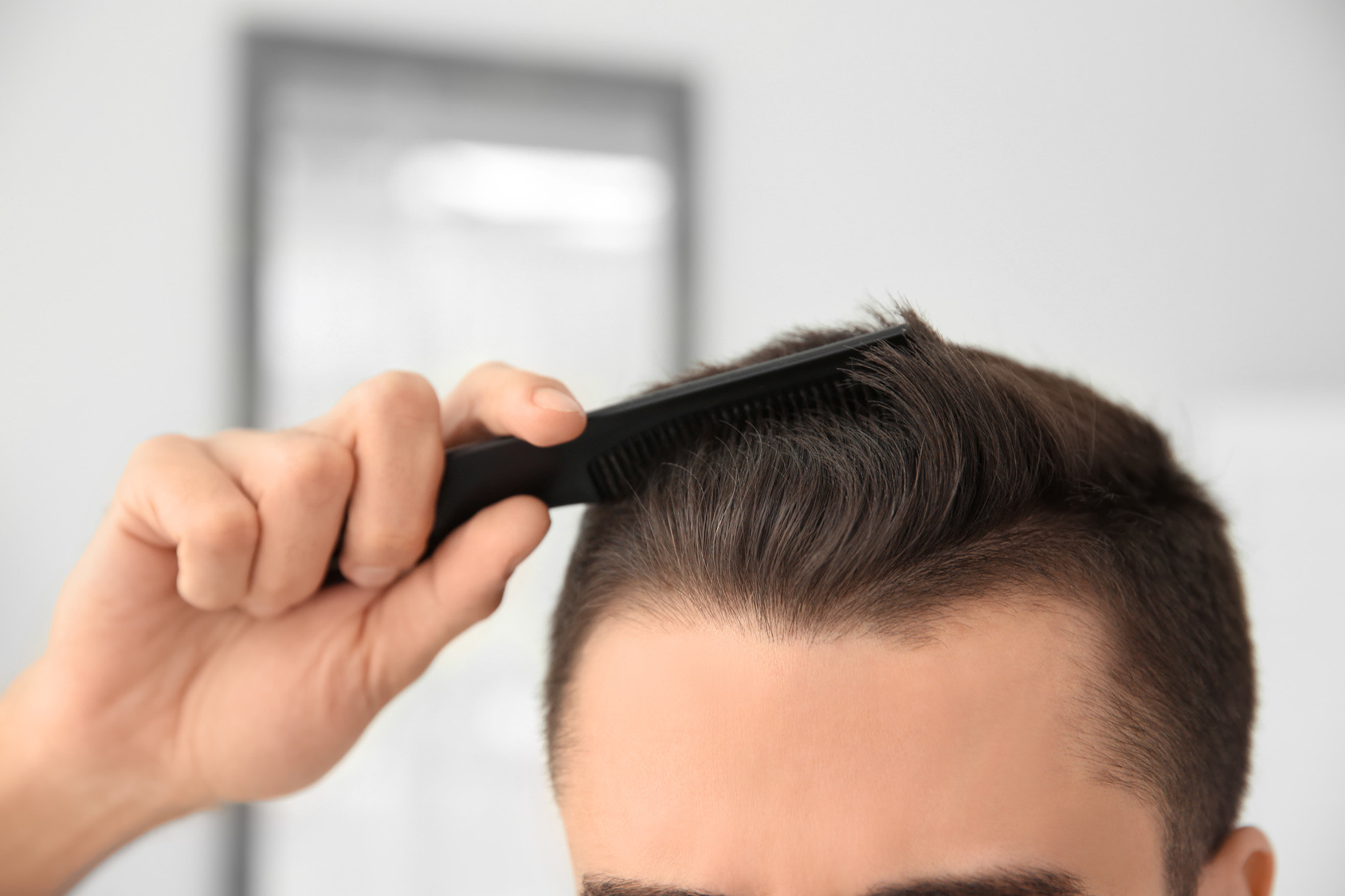 Haartransplantation bei Geheimratsecken