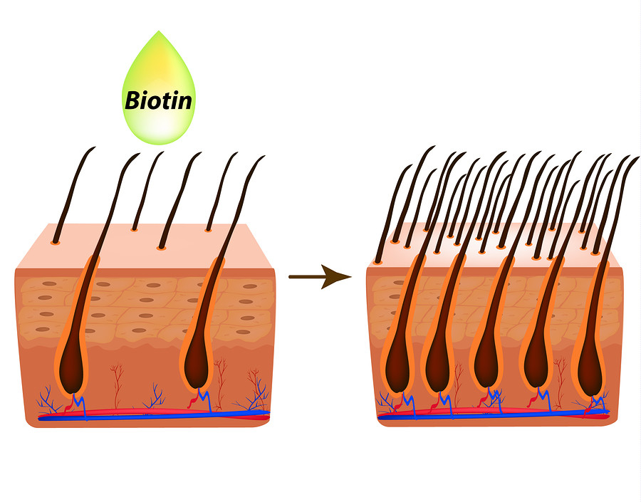Biotin bei Haarausfall