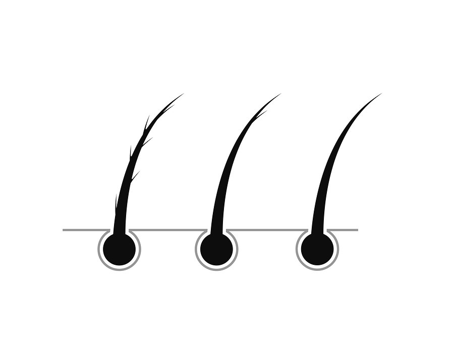 Haarfollikel