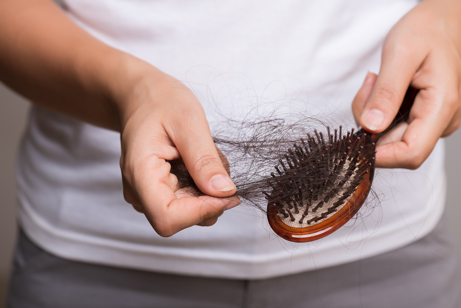Haartransplantation mit Fremdhaar