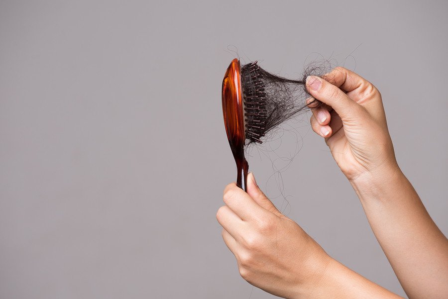 Anlagebedingter Haarausfall bei Frauen