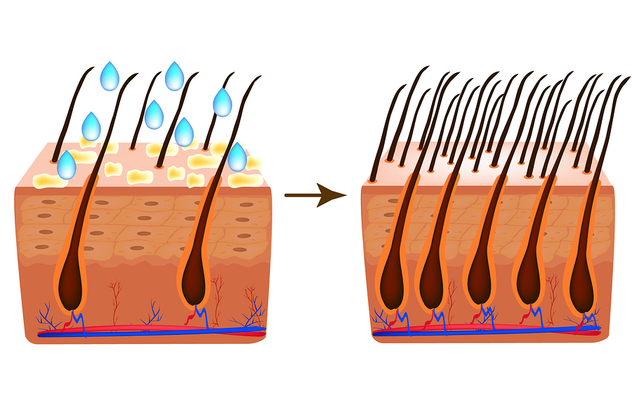 Biotin gegen Haarausfall