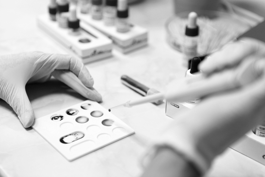 Haarausfall bei Diabetes mellitus