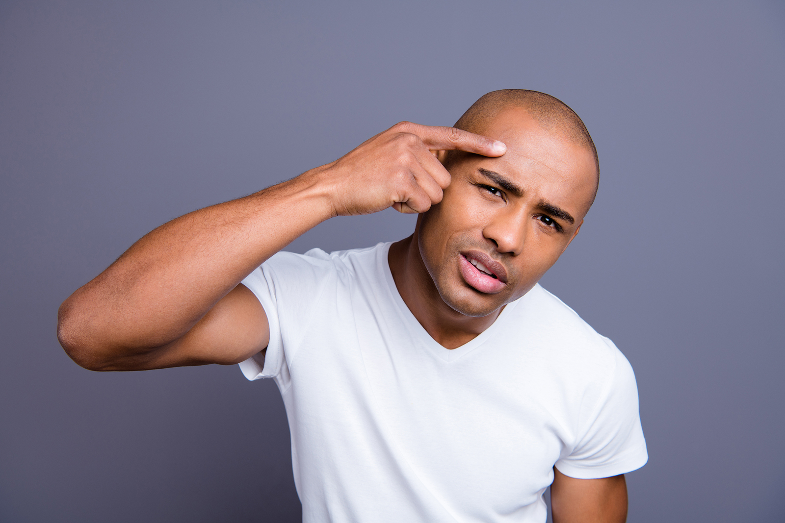 Stirn verkleinern durch Haartransplantation