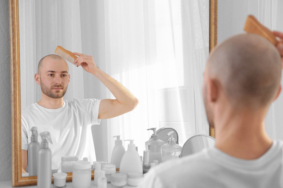 Der Glatzenbildung effektiv entgegenwirken