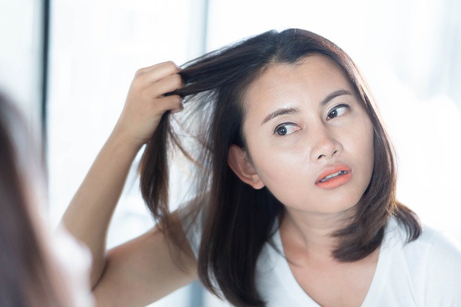 Haarausfall am Haaransatz meistens erblich bedingt