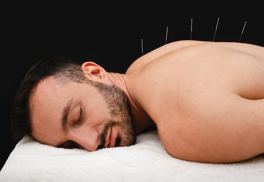 Akupunktur kann Haarausfall stoppen
