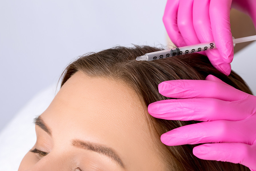 Kann die Haardichte mit einer Eigenbluttherapie verbessert werden
