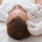 AC-Therapie bei Haarausfall