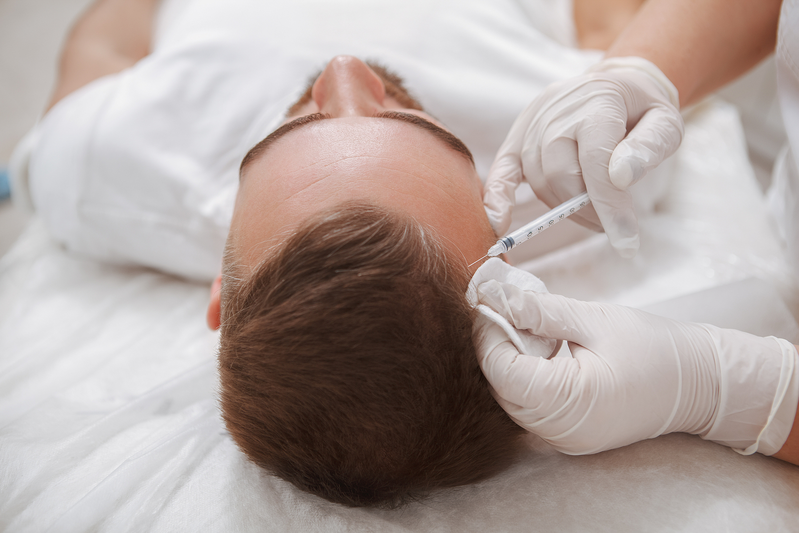 AC-Therapie bei Haarausfall