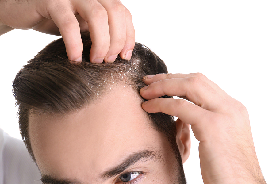 Krusten nach der Haartransplantation