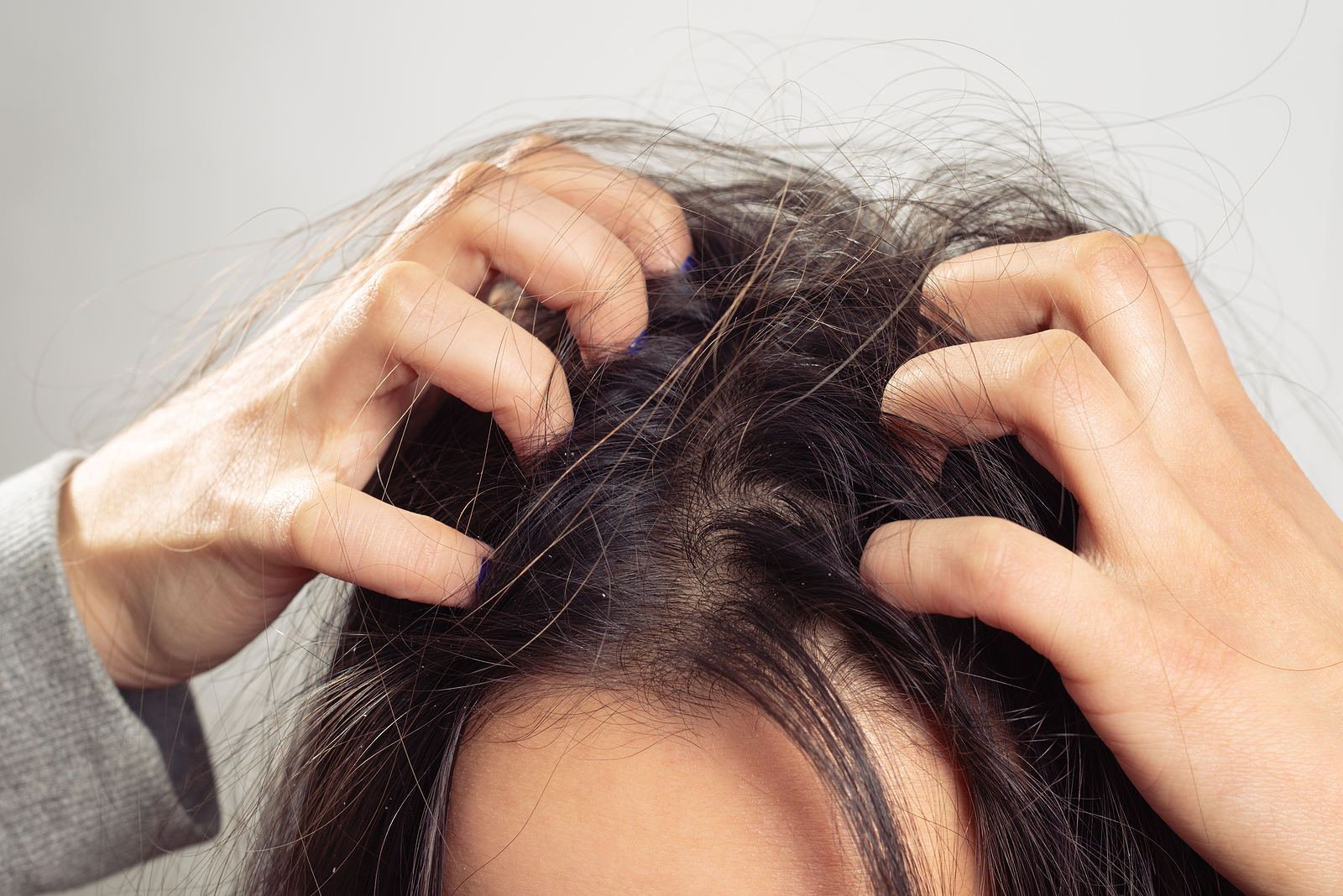 Haarausfall und fettige Haare richtig behandeln