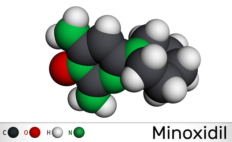 Minoxidil bei Geheimratsecken